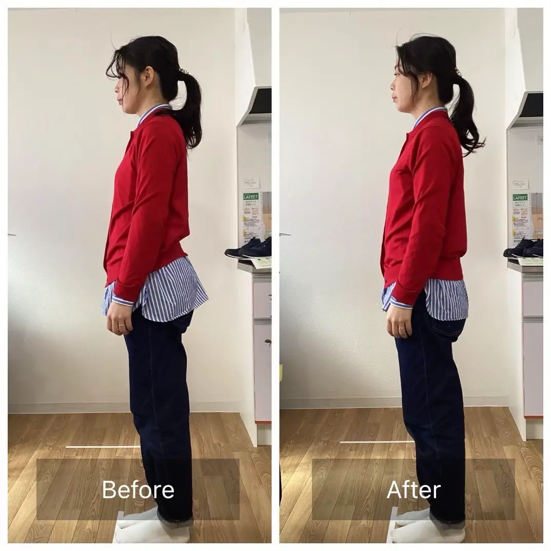 BeforeAfter 3