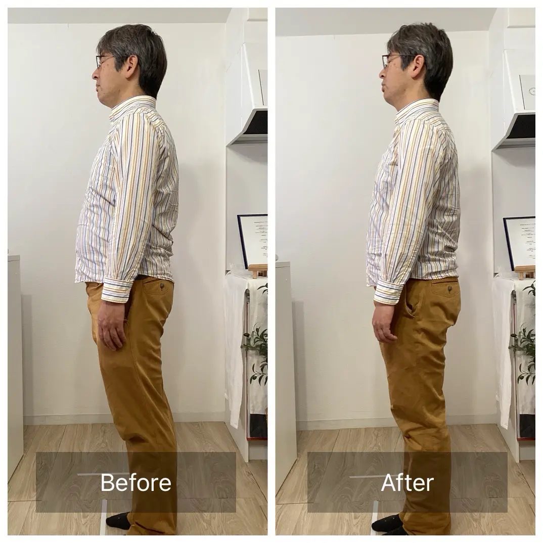 BeforeAfter 4
